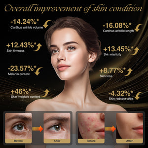 Supdesir 4D Laser Light Therapy Mask